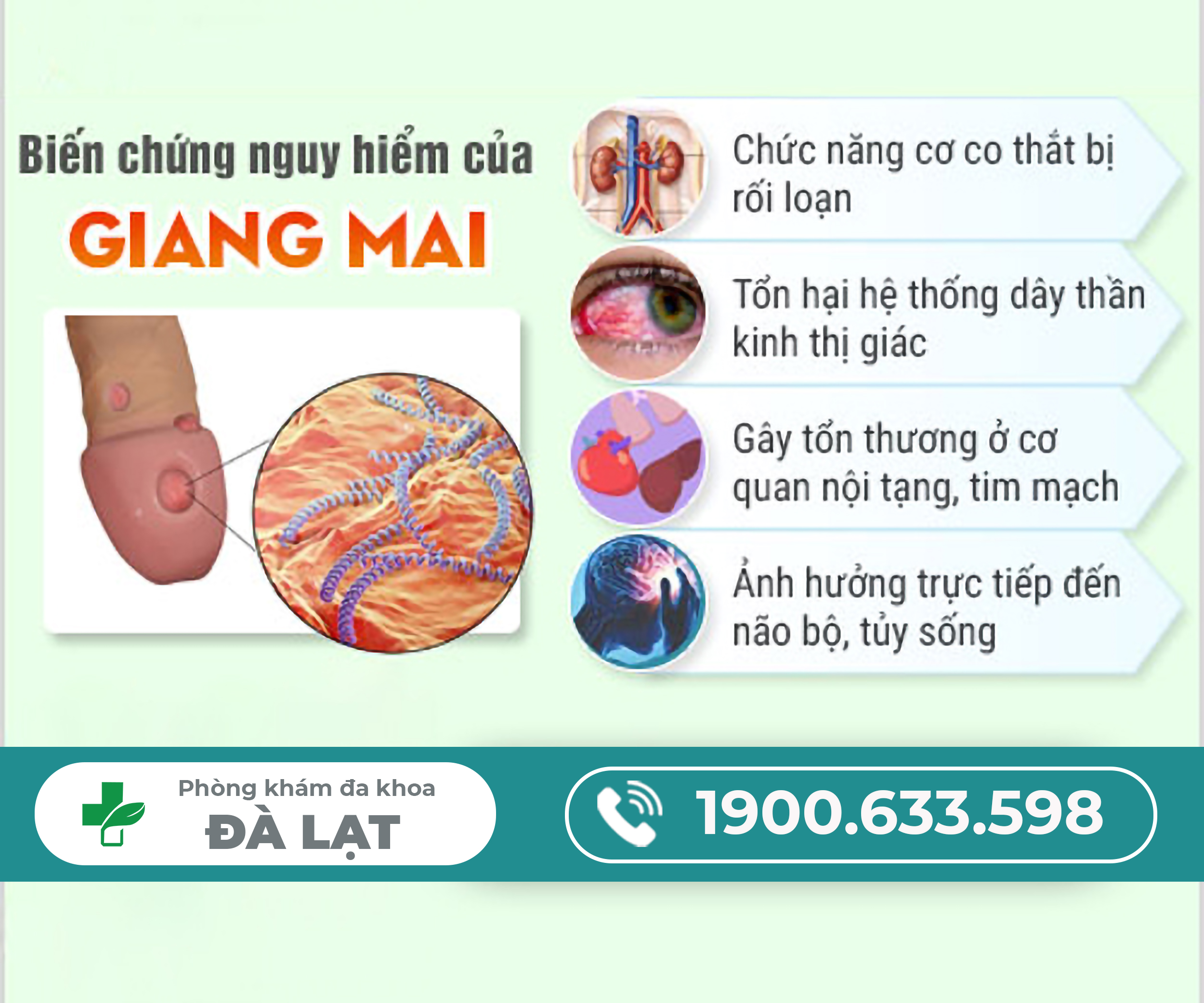 Hình ảnh minh họa